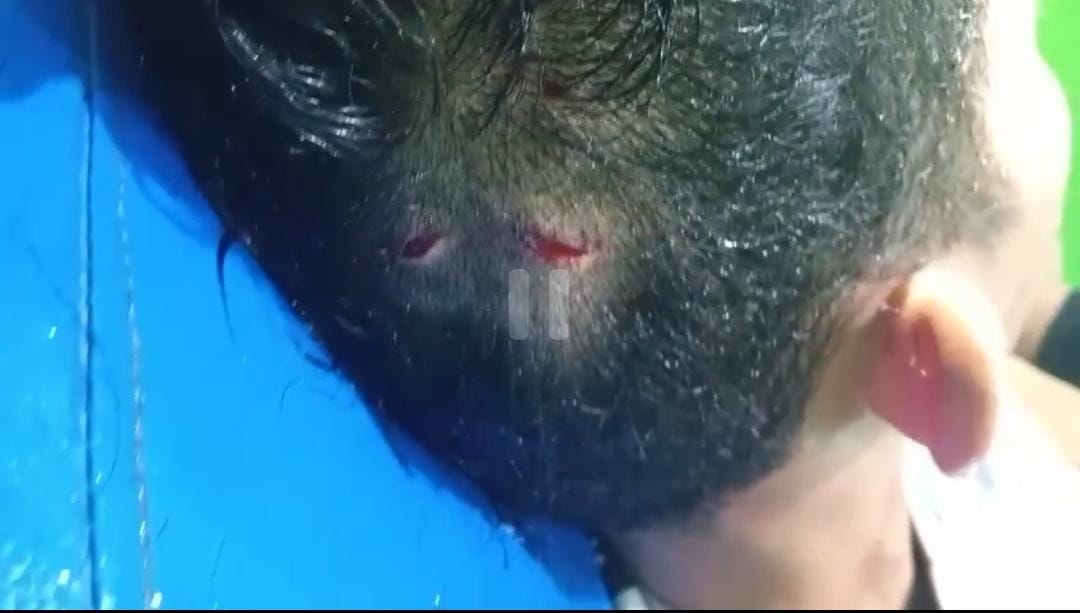 Brutal! MCA Diserang Botol dan Sajam, Pelaku sudah Teridentifikasi Tapi Belum Ditangkap