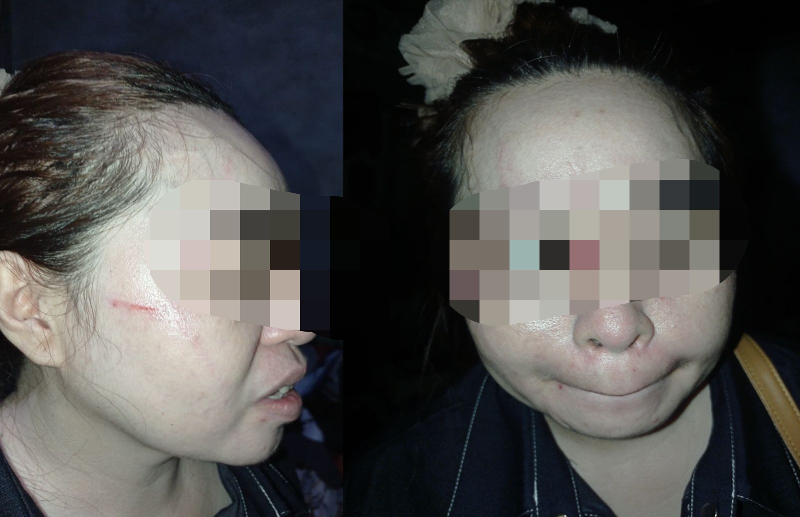 Drama Cemburu Berujung Kekerasan di Buton Utara, Pacar Oknum Polisi Dicakar Istri Siri